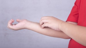 young boy scratching arm allergy